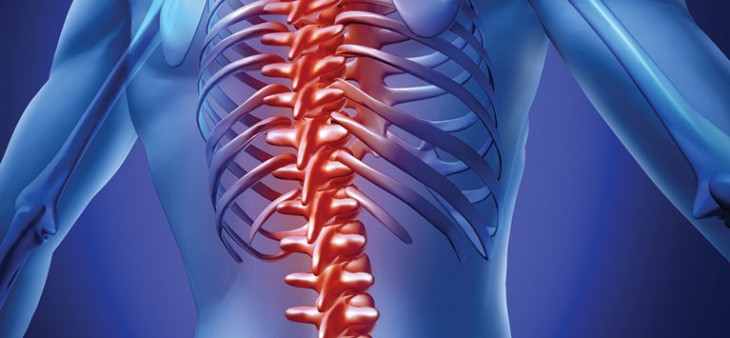back-pain