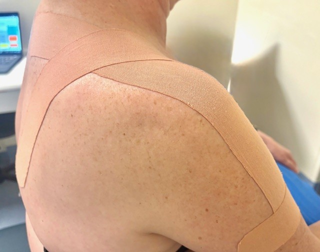 Musculoskeletal physiotherapy Adelaide 